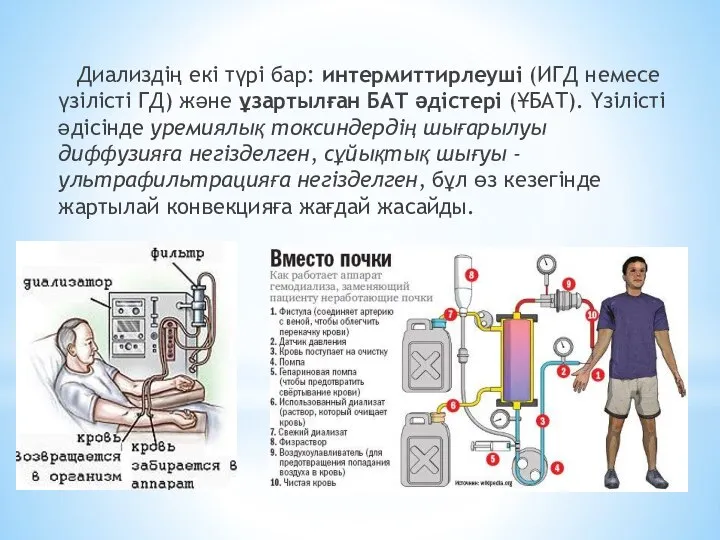 Диализдің екі түрі бар: интермиттирлеуші (ИГД немесе үзілісті ГД) және ұзартылған