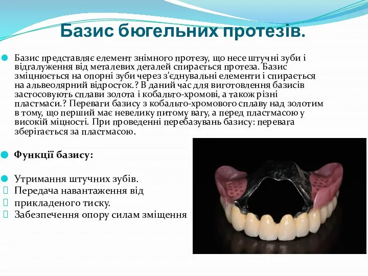 Базис бюгельних протезів. Базис представляє елемент знімного протезу, що несе штучні