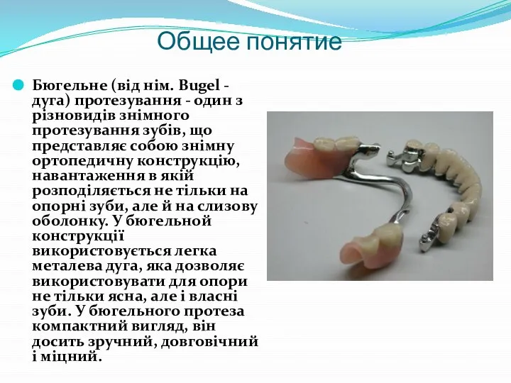 Общее понятие Бюгельне (від нім. Bugel - дуга) протезування - один