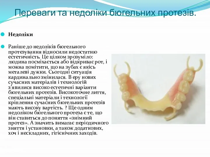 Переваги та недоліки бюгельних протезів. Недоліки Раніше до недоліків бюгельного протезування