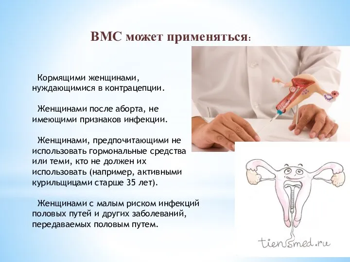 ВМС может применяться: Кормящими женщинами, нуждающимися в контрацепции. Женщинами после аборта,