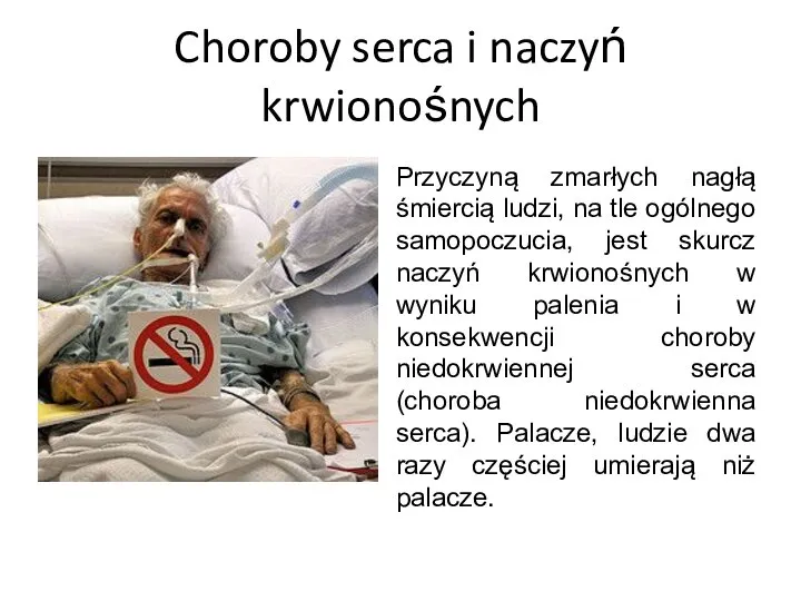 Choroby serca i naczyń krwionośnych Przyczyną zmarłych nagłą śmiercią ludzi, na