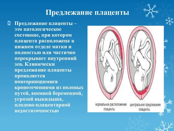 Предлежание плаценты Предлежание плаценты – это патологическое состояние, при котором плацента