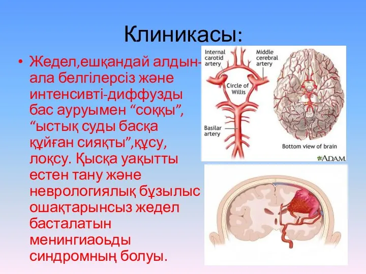 Клиникасы: Жедел,ешқандай алдын-ала белгілерсіз және интенсивті-диффузды бас ауруымен “соққы”, “ыстық суды