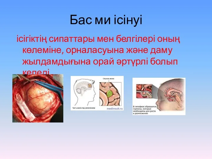 Бас ми ісінуі ісігіктің сипаттары мен белгілері оның көлеміне, орналасуына және