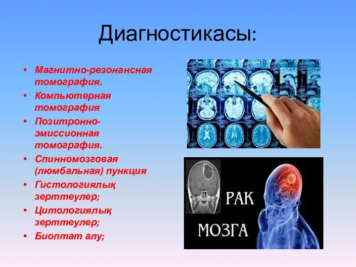 Диагностикасы: Магнитно-резонансная томография. Компьютерная томография Позитронно-эмиссионная томография. Спинномозговая (люмбальная) пункция Гистологиялық зерттеулер; Цитологиялық зерттеулер; Биоптат алу;