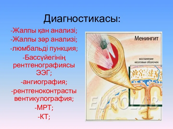 Диагностикасы: -Жалпы қан анализі; -Жалпы зәр анализі; -люмбальді пункция; -Бассүйегінің рентгенографиясы