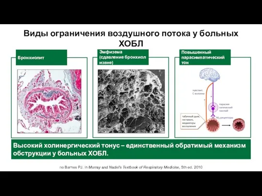 по Barnes PJ. in Murray and Nadel's Textbook of Respiratory Medicine,