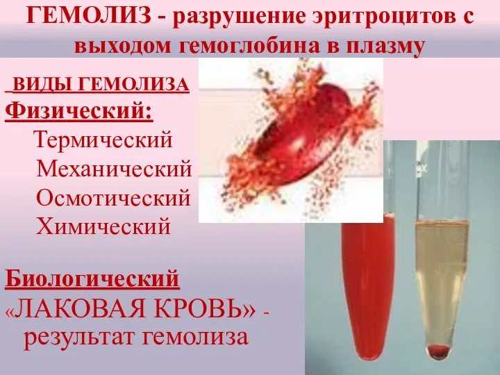 ГЕМОЛИЗ - разрушение эритроцитов с выходом гемоглобина в плазму ВИДЫ ГЕМОЛИЗА