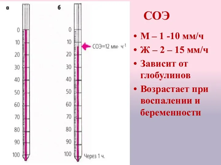 СОЭ М – 1 -10 мм/ч Ж – 2 – 15