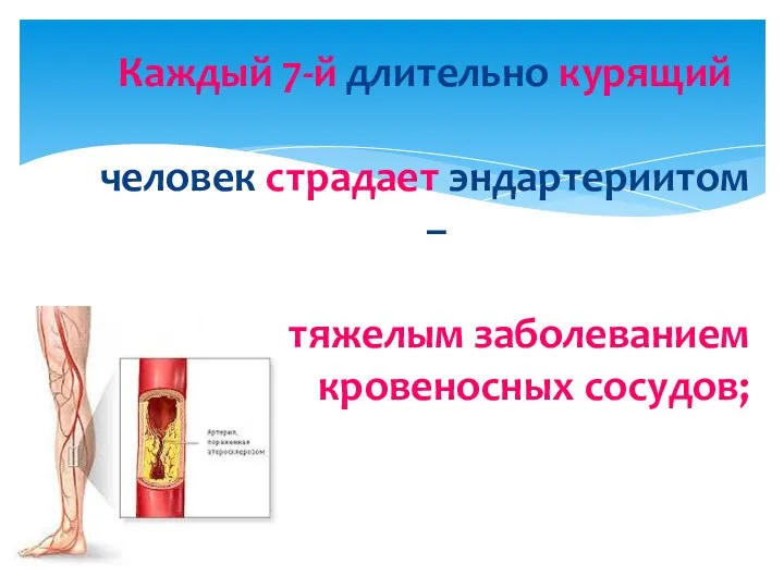 Каждый 7-й длительно курящий человек страдает эндартериитом – тяжелым заболеванием кровеносных сосудов;