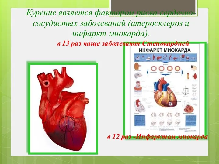 Курение является фактором риска сердечно-сосудистых заболеваний (атеросклероз и инфаркт миокарда). в