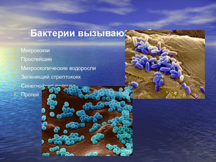 Бактерии вызывающие болезни Микрококки Простейшие Микроскопические водоросли Зеленящий стрептококк Синегнойная палочка Протей