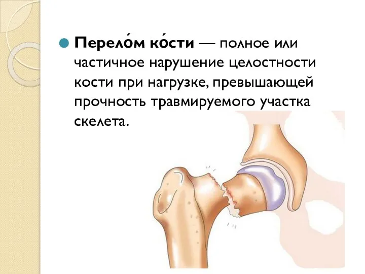 Перело́м ко́сти — полное или частичное нарушение целостности кости при нагрузке, превышающей прочность травмируемого участка скелета.