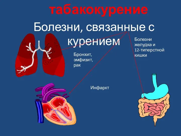 Болезни, связанные с курением Бронхит, эмфизит, рак Инфаркт Болезни желудка и 12-типерстной кишки табакокурение