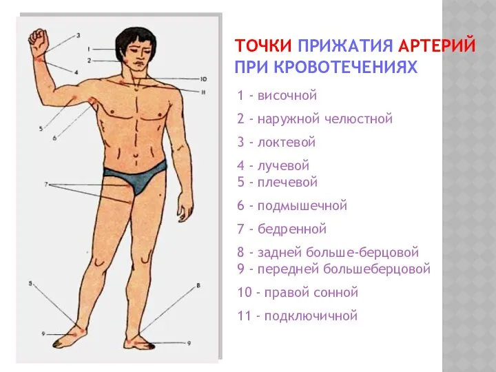 ТОЧКИ ПРИЖАТИЯ АРТЕРИЙ ПРИ КРОВОТЕЧЕНИЯХ 1 - височной 2 - наружной