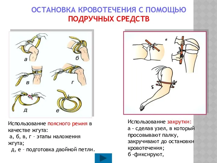 ОСТАНОВКА КРОВОТЕЧЕНИЯ С ПОМОЩЬЮ ПОДРУЧНЫХ СРЕДСТВ Использование поясного ремня в качестве