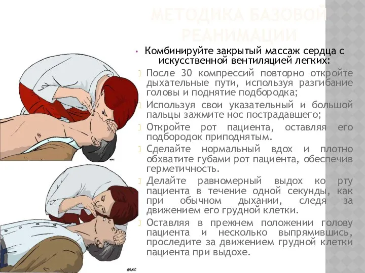 Комбинируйте закрытый массаж сердца с искусственной вентиляцией легких: После 30 компрессий