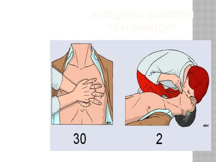 МЕТОДИКА БАЗОВОЙ РЕАНИМАЦИИ