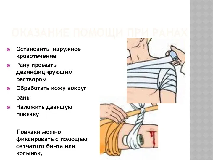 ОКАЗАНИЕ ПОМОЩИ ПРИ РАНАХ Остановить наружное кровотечение Рану промыть дезинфицирующим раствором