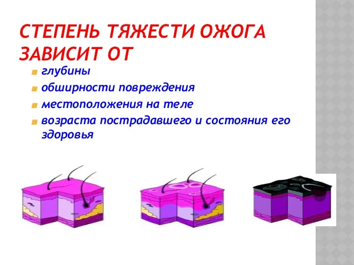 СТЕПЕНЬ ТЯЖЕСТИ ОЖОГА ЗАВИСИТ ОТ глубины обширности повреждения местоположения на теле