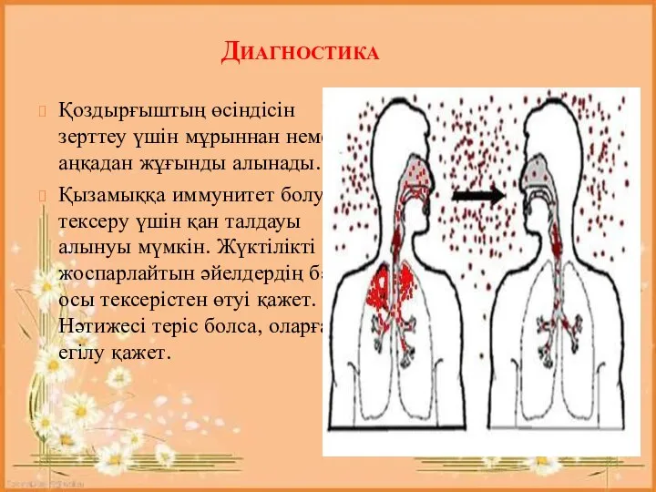 Диагностика Қоздырғыштың өсіндісін зерттеу үшін мұрыннан немесе аңқадан жұғынды алынады. Қызамыққа