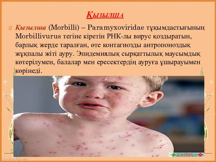 Қызылша Қызылша (Morbillі) – Paramyxoviridae тұқымдастығының Morbillivurus тегіне кіретін РНК-лы вирус