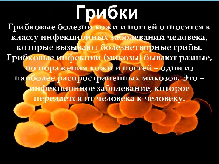 Грибки Грибковые болезни кожи и ногтей относятся к классу инфекционных заболеваний