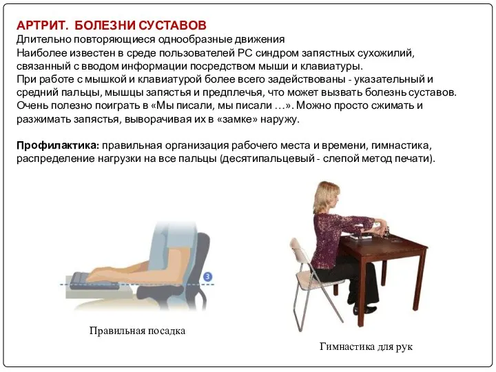 АРТРИТ. БОЛЕЗНИ СУСТАВОВ Длительно повторяющиеся однообразные движения Наиболее известен в среде