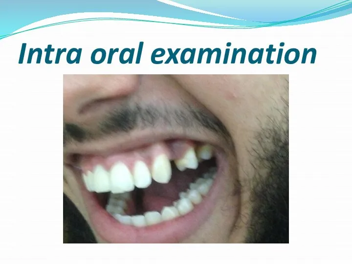 Intra oral examination