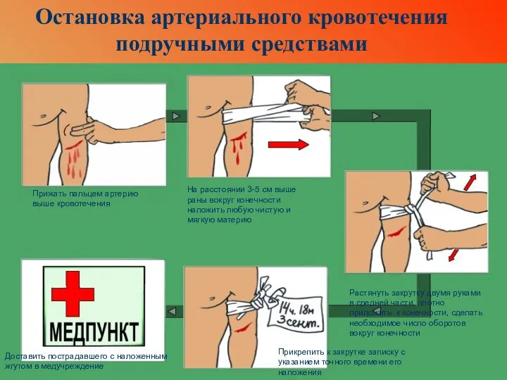 Остановка артериального кровотечения подручными средствами Прижать пальцем артерию выше кровотечения На