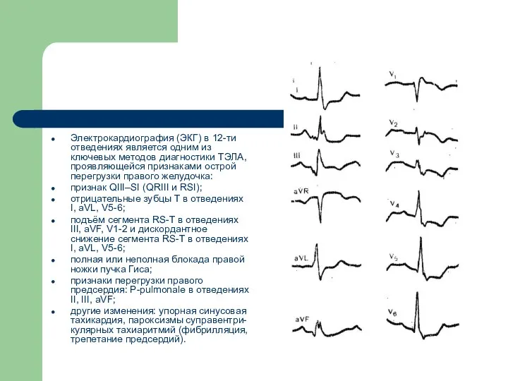 Электрокардиография (ЭКГ) в 12-ти отведениях является одним из ключевых методов диагностики