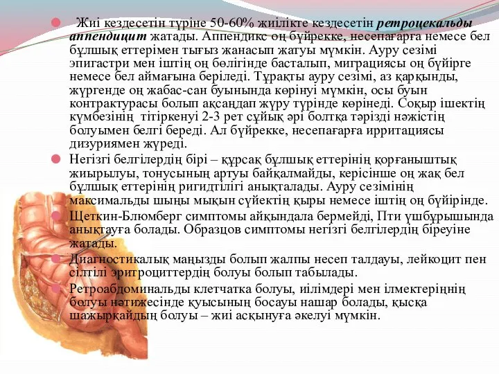 Жиі кездесетін түріне 50-60% жиілікте кездесетін ретроцекальды аппендицит жатады. Аппендикс оң