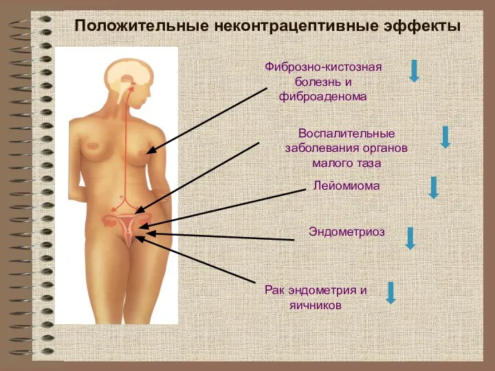 Фиброзно-кистозная болезнь и фиброаденома Воспалительные заболевания органов малого таза Лейомиома Эндометриоз