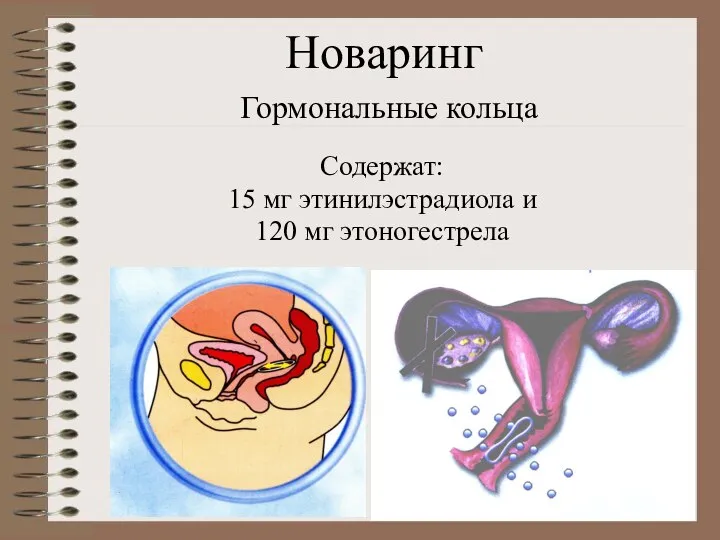 Новаринг Гормональные кольца Содержат: 15 мг этинилэстрадиола и 120 мг этоногестрела