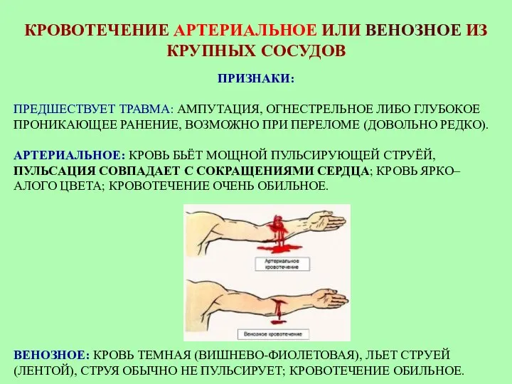 КРОВОТЕЧЕНИЕ АРТЕРИАЛЬНОЕ ИЛИ ВЕНОЗНОЕ ИЗ КРУПНЫХ СОСУДОВ ПРИЗНАКИ: ПРЕДШЕСТВУЕТ ТРАВМА: АМПУТАЦИЯ,