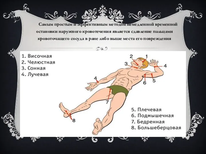 Самым простым и эффективным методом немедленной временной остановки наружного кровотечения является