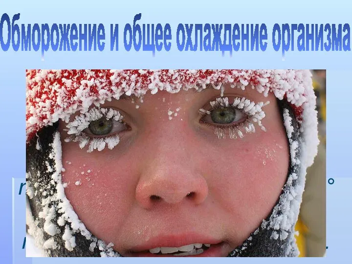 Наступают при температуре воздуха ниже -6°С. Снижение внутренней температуры тела ниже