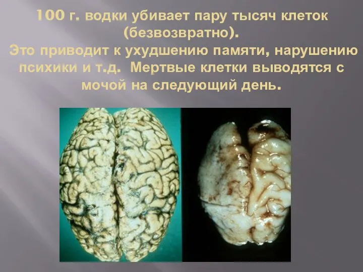 100 г. водки убивает пару тысяч клеток (безвозвратно). Это приводит к