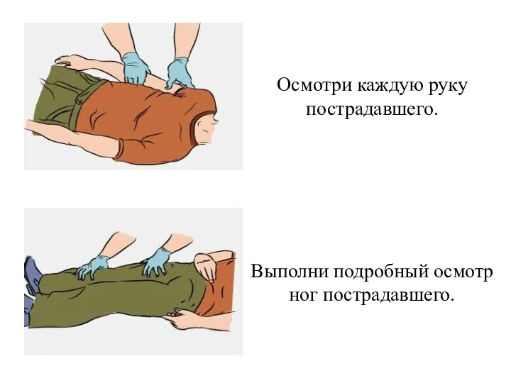 Осмотри каждую руку пострадавшего. Выполни подробный осмотр ног пострадавшего.