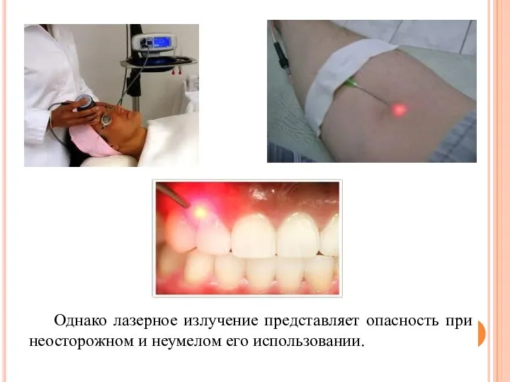 Однако лазерное излучение представляет опасность при неосторожном и неумелом его использовании.