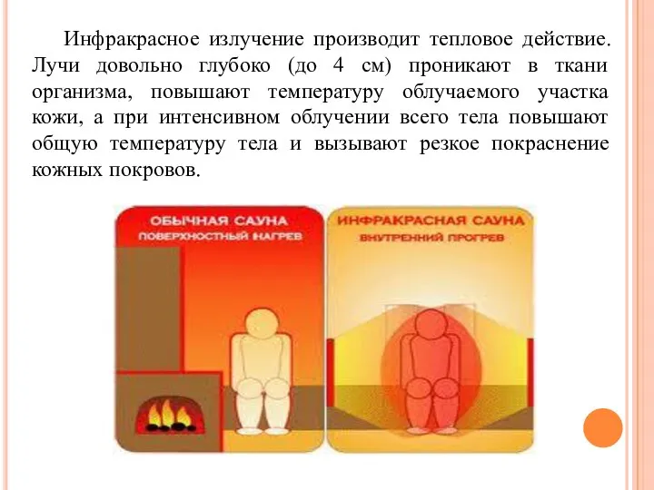 Инфракрасное излучение производит тепловое действие. Лучи довольно глубоко (до 4 см)