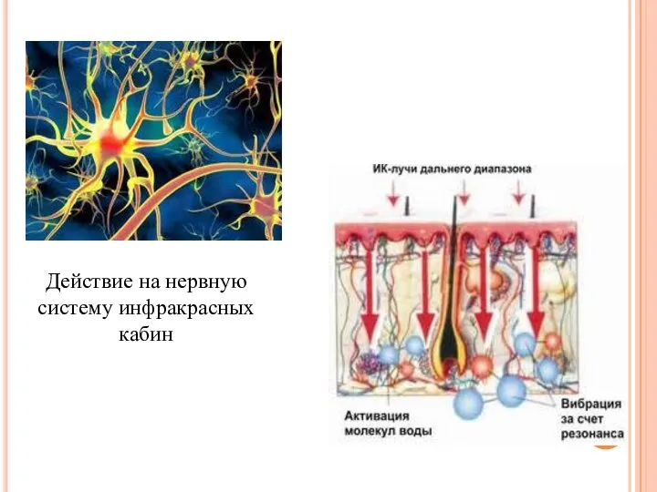 Действие на нервную систему инфракрасных кабин
