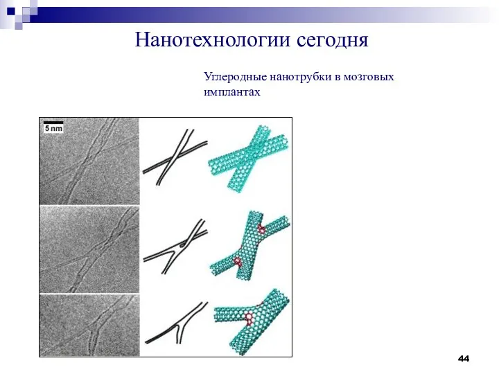 Нанотехнологии сегодня Углеродные нанотрубки в мозговых имплантах