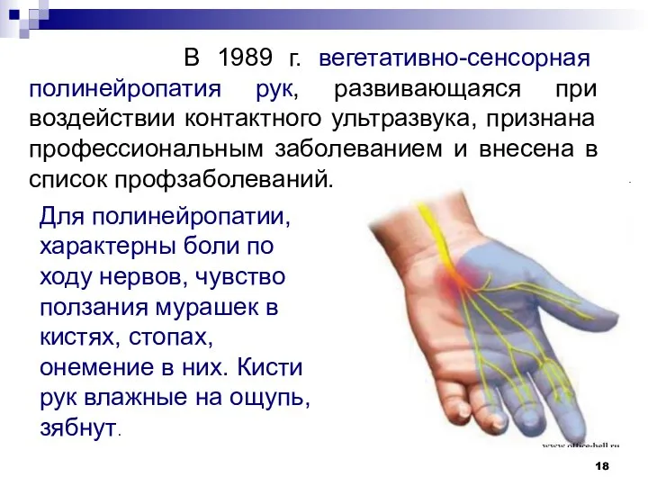 В 1989 г. вегетативно-сенсорная полинейропатия рук, развивающаяся при воздействии контактного ультразвука,