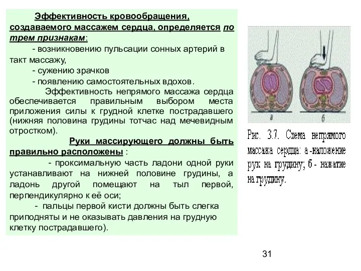 Эффективность кровообращения, создаваемого массажем сердца, определяется по трем признакам: - возникновению