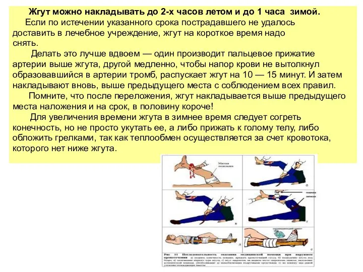 Жгут можно накладывать до 2-х часов летом и до 1 часа