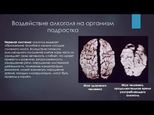 Воздействие алкоголя на организм подростка Нервная система: алкоголь вызывает образование тромбов