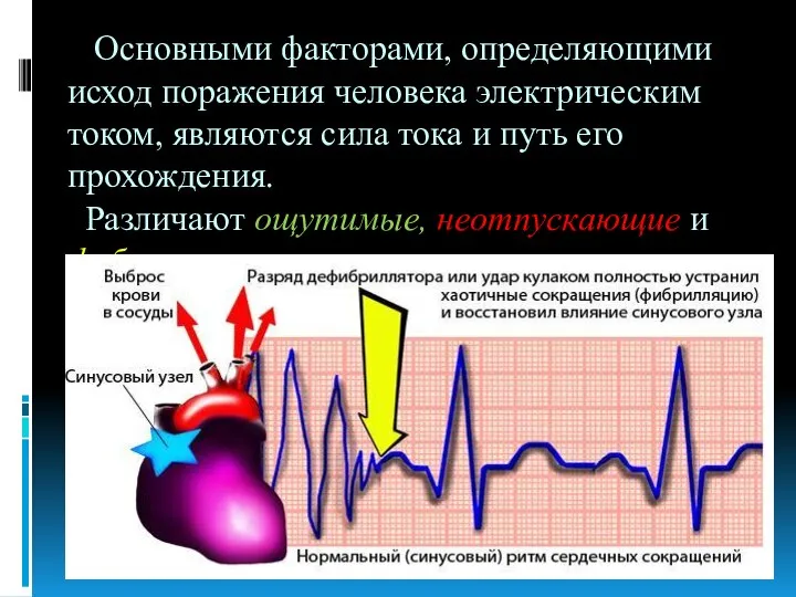 Основными факторами, определяющими исход поражения человека электрическим током, являются сила тока