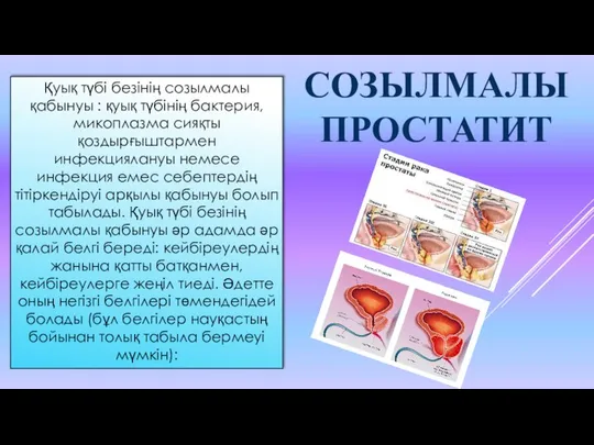 Қуық түбі безінің созылмалы қабынуы : қуық түбінің бактерия, микоплазма сияқты